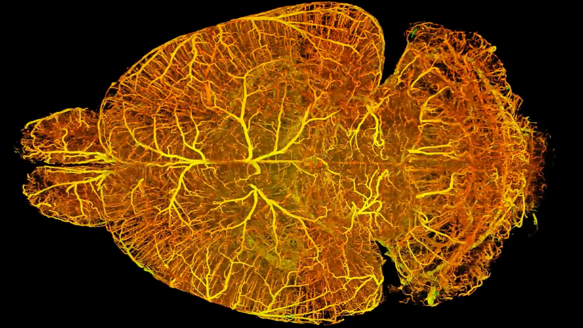 Scientists Use AI To Create Transparent 3D Images of Organs